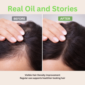 AYUVERA Kesh Veda Ayurvedic Hair Oil – Herbal Oil for Hair Fall Control & Healthy Hair